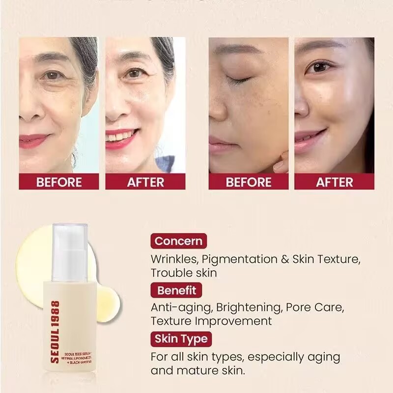 SEOUL 1988, juego hidratante i - Retinol Vitamin A Cream reseña y precio