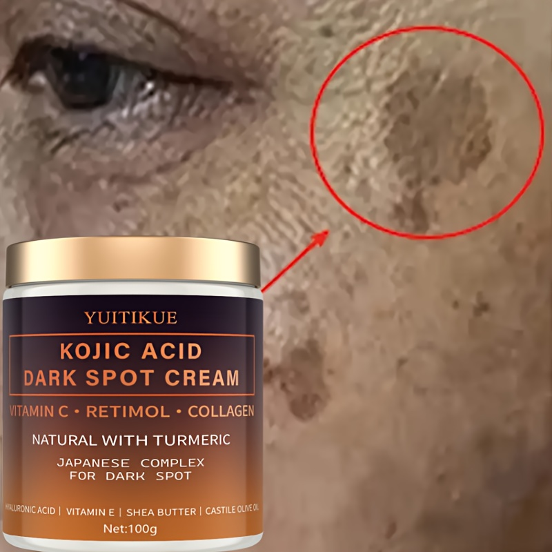 Crema decolorante de arbutina, - Retinol Vitamin A Cream reseña y precio